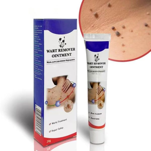Warts Remover ointment