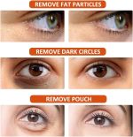 Milia Remover Essential - Image 4
