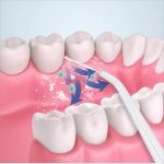 3 In 1 Oral Irrigator - Image 5