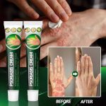 Psoriasis Cream - Herbal Plant Extracts - Image 4