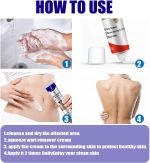 Warts Remover ointment - Image 5