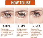 Milia Remover Essential - Image 5