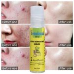 Temulawak - New Acne Removing Serum (Original) - Image 3