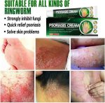 Psoriasis Cream - Herbal Plant Extracts - Image 3