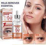 Smooth Milia Remover Serum (30ml) - Image 4