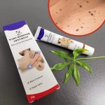 Warts Remover ointment - Image 2